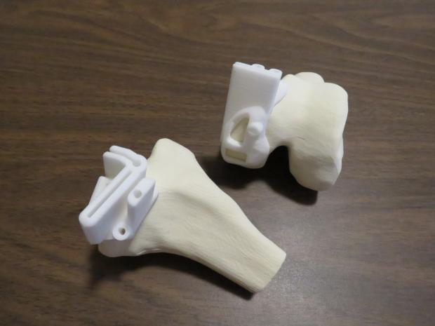 3D-printed devices improve surgical outcomes