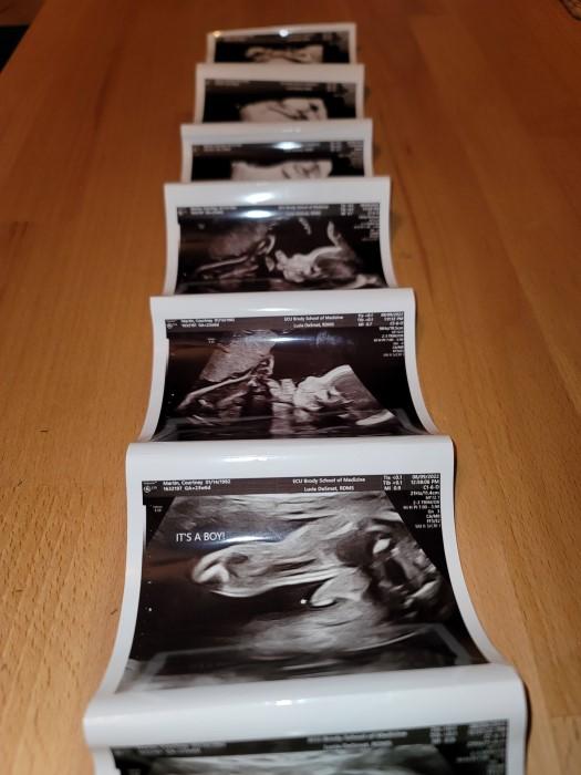 Ultrasound images of a baby